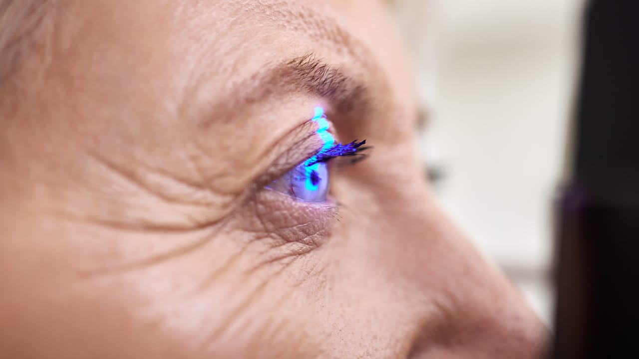 Diyabetik Retinopati Nedir? Belirtileri ve Tedavisi