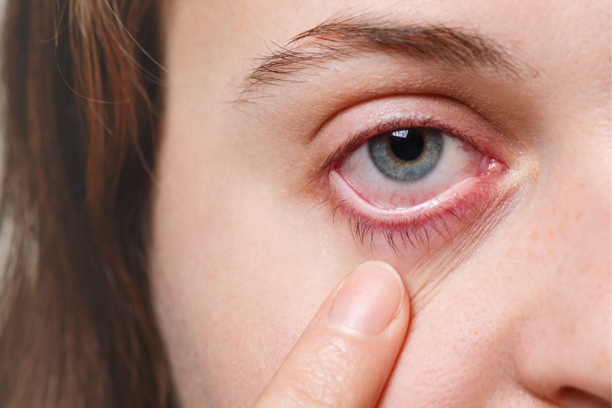 What is Eye Infection and What are its Symptoms?