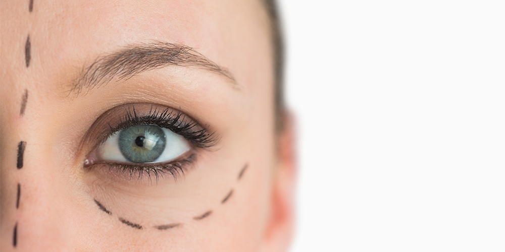 Eye Lining Surgery and What You Need to Know